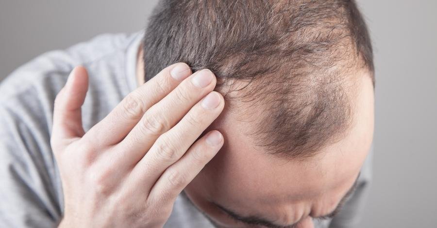 Hair Fall Treatment
